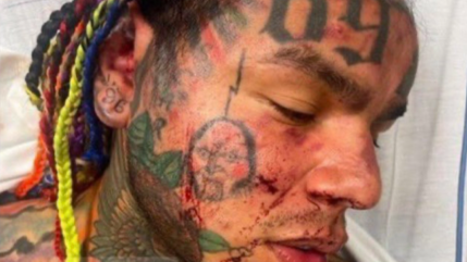 6ix9ine grièvement blessé après son passage à tabac